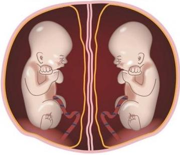 En el vientre de la madre conversan dos embriones sobre Renacimiento